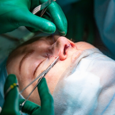 جراحی بینی استخوانی